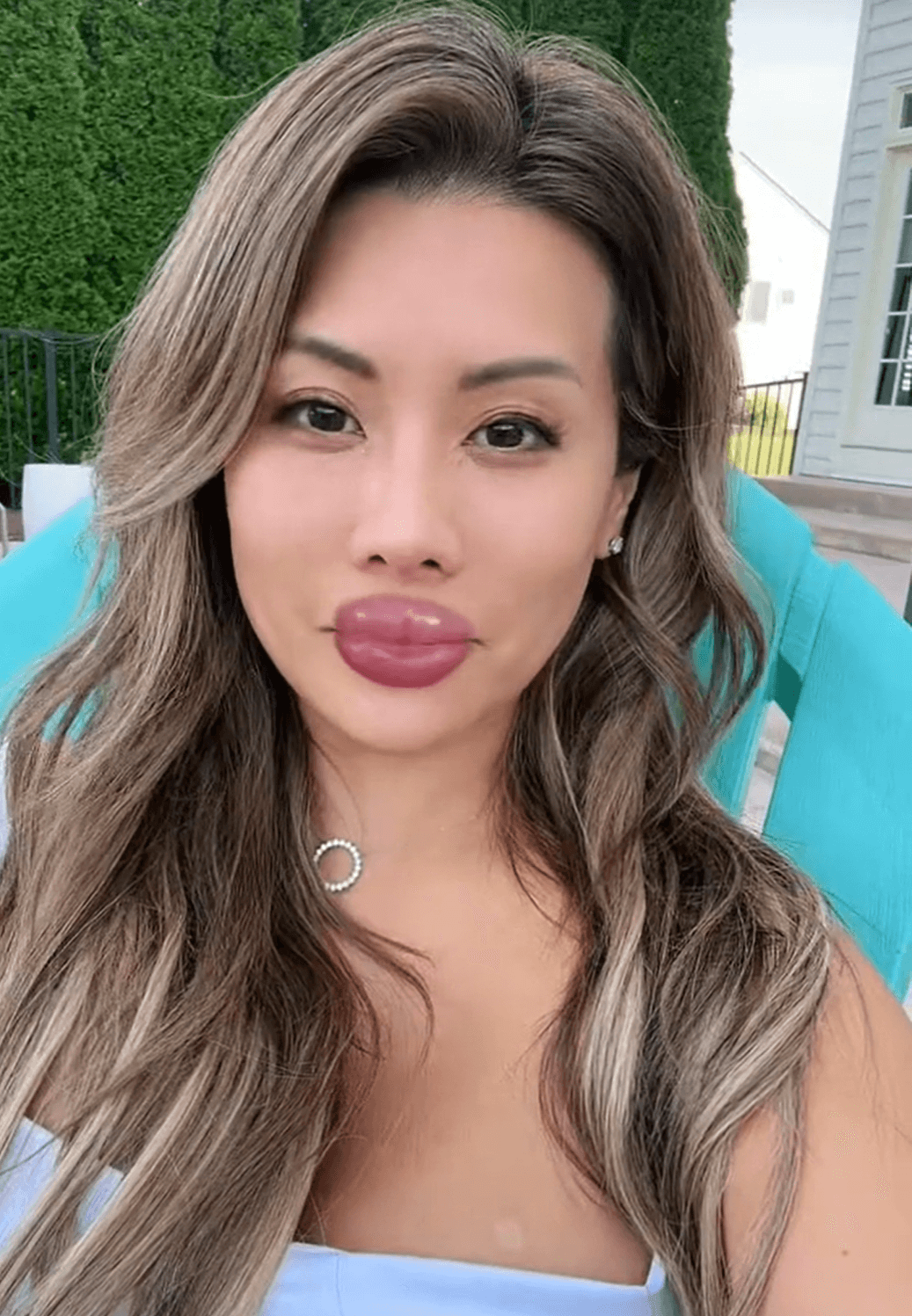 TikTok’s duck lip filter is the new lip filler challenge minus the